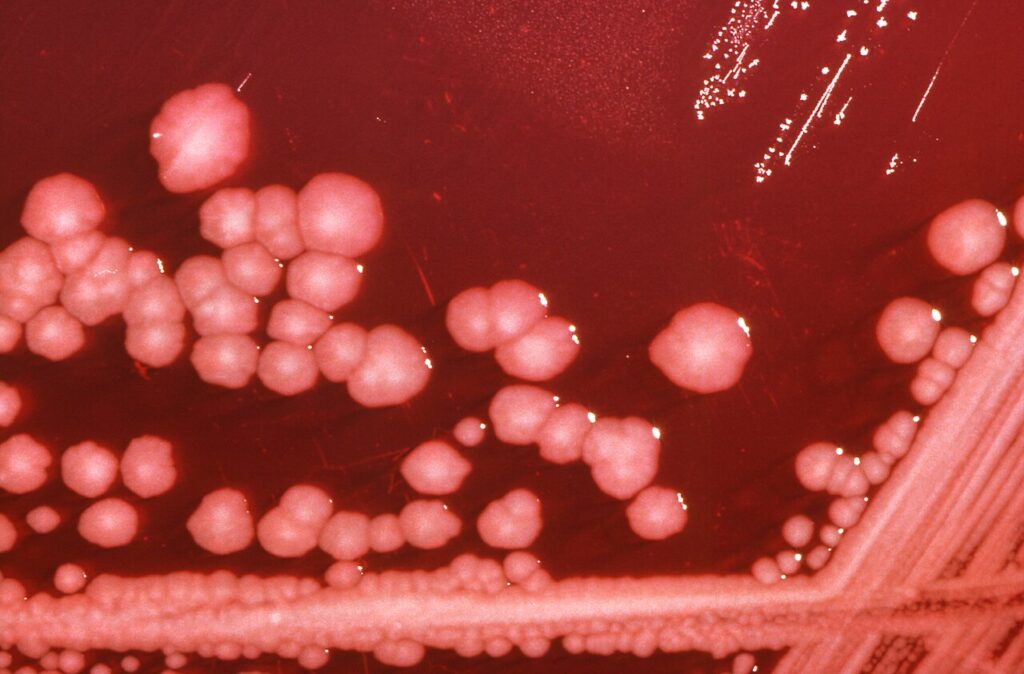 Colonias de la bacteria Proteus mirabilis creciendo en una placa de cultivo