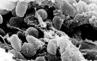 Micrografía electrónica de bacterias Yersinia pestis en el intestino de una pulga