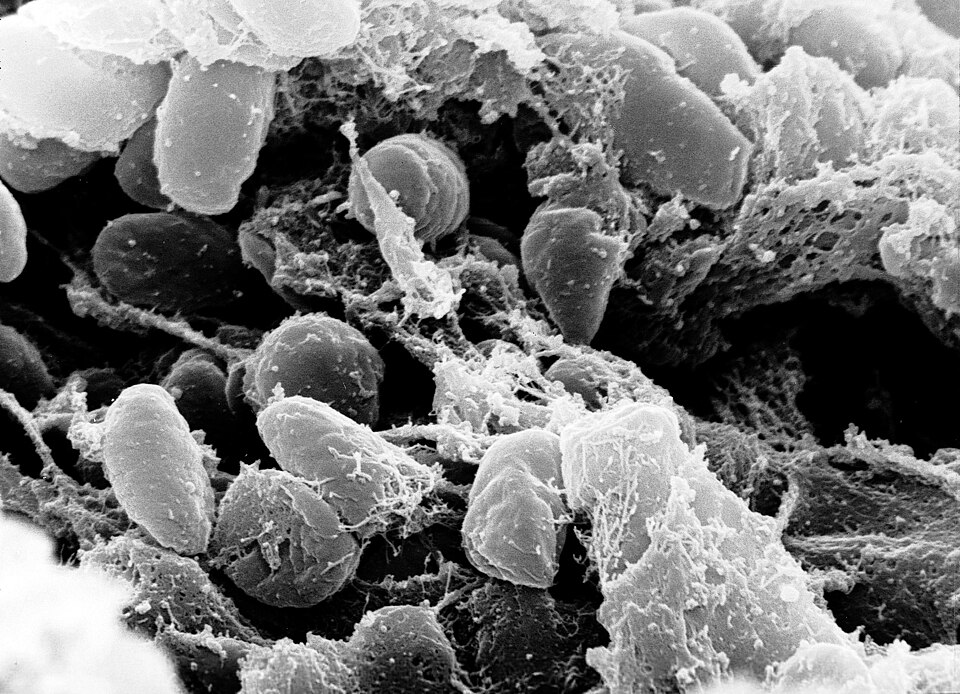 Micrografía electrónica de bacterias Yersinia pestis en el intestino de una pulga
